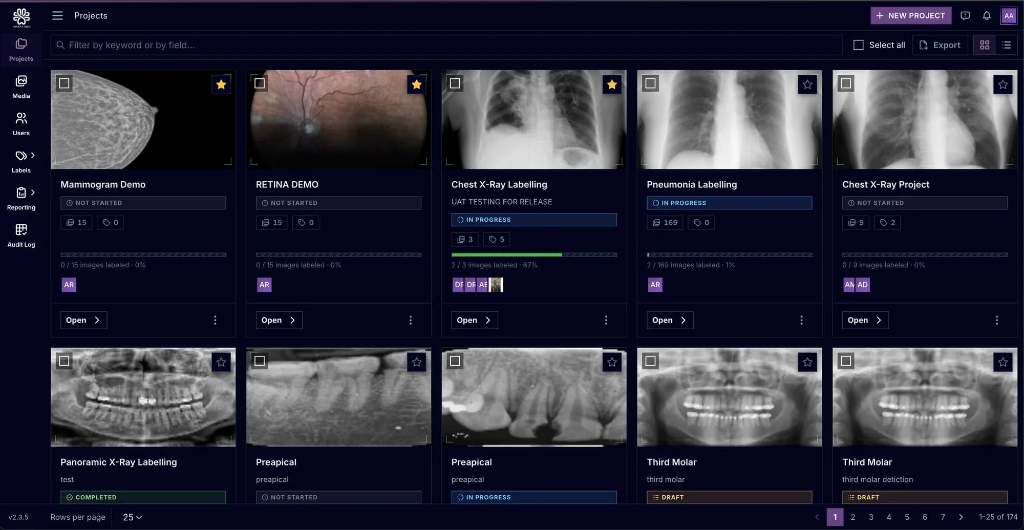 SAIF project dashboard: a grid of labelling projects across radiographs, retinal, mammography and dental images, each with a status, an image count and a progress bar.